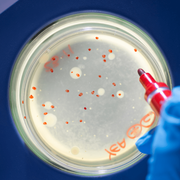 Bioburden Petri Plate Counting